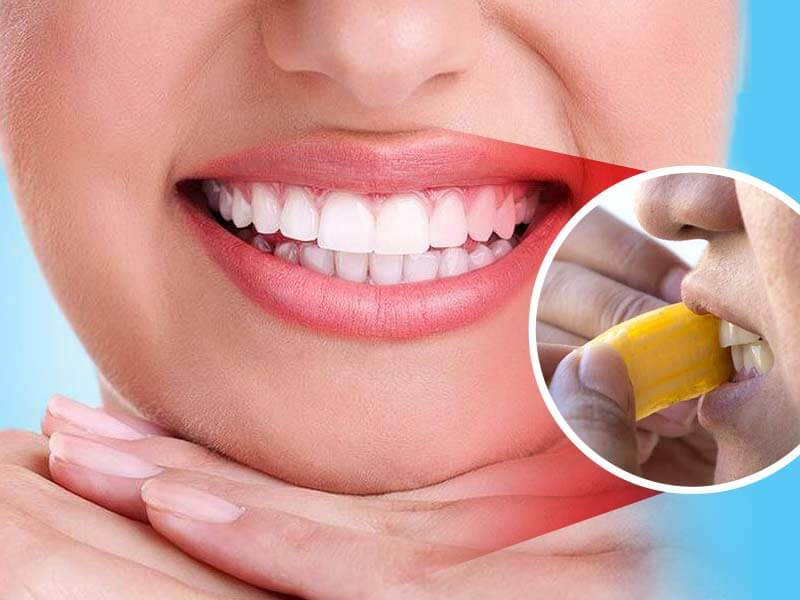 yellowing of teeth peel the bananas