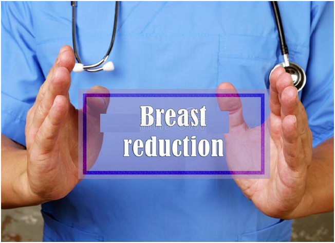 Breast reduction Surgery: Things to consider