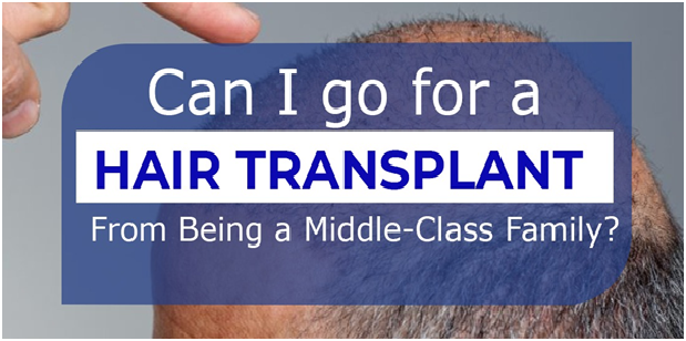 Can I go for a hair transplant from being a middle-class family?