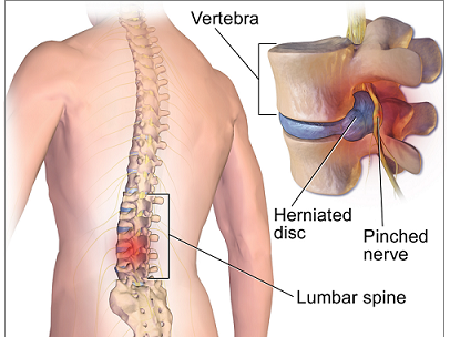 A ROAD TO RECOVERY AFTER SPINE SURGERY