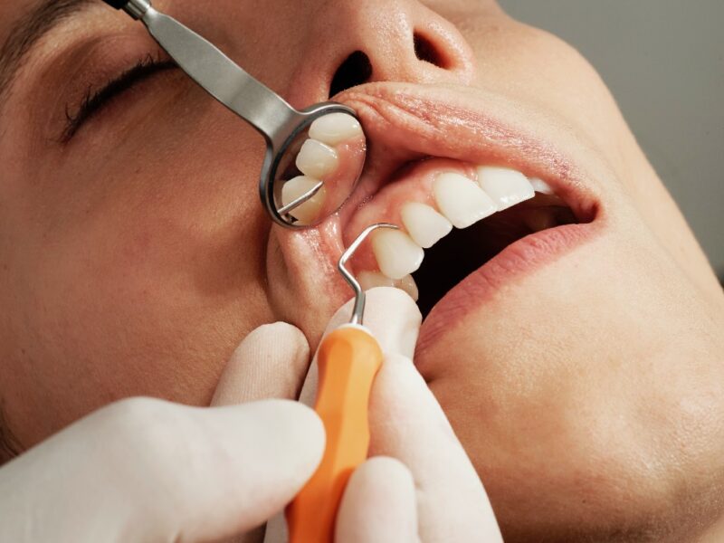 5 types of dental surgery in Canberra