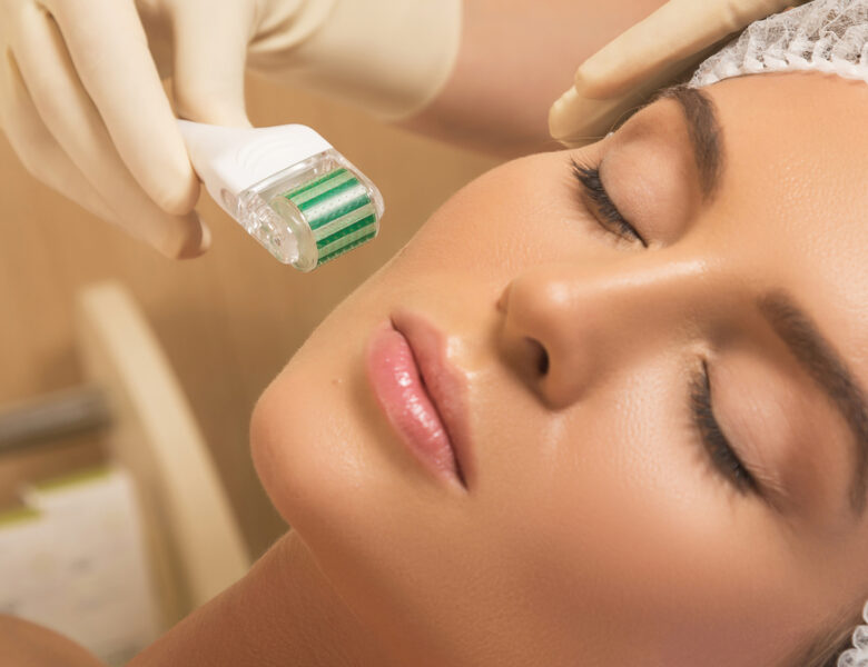 What is Micro needling? Things to know about Micro Needle Treatment