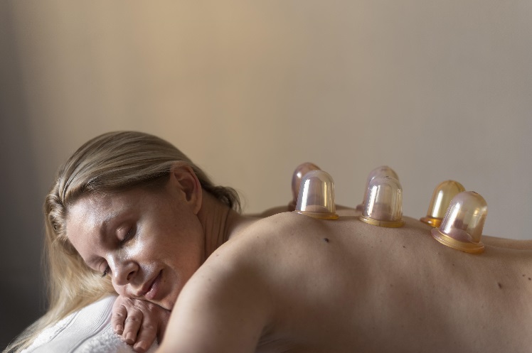 7 Surprising Benefits of Cupping Therapy