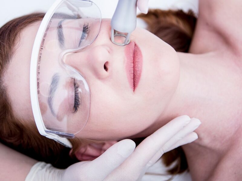 What Is Laser Facial Treatment and How Does It Work?