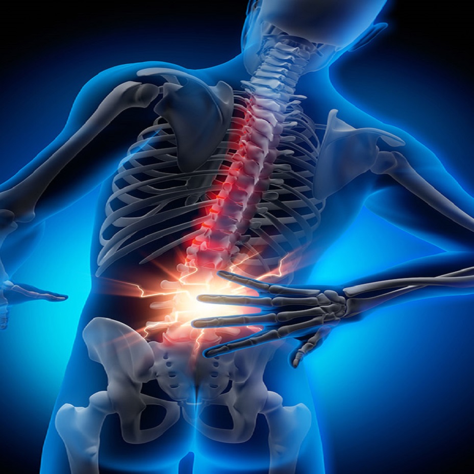 Back Pain: Causes, Symptoms, Prevention & Treatment | MyLargeBox